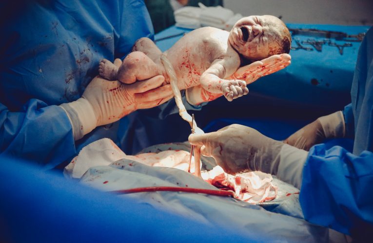 Baby care tips after c-section birth